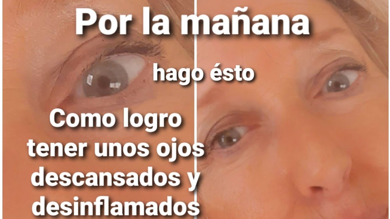 QUE HAGO POR LA MAÑANA PARA TENER UNOS OJOS DESCANSADOS Y DESINFLAMADOS .GENIAL¡¡¡