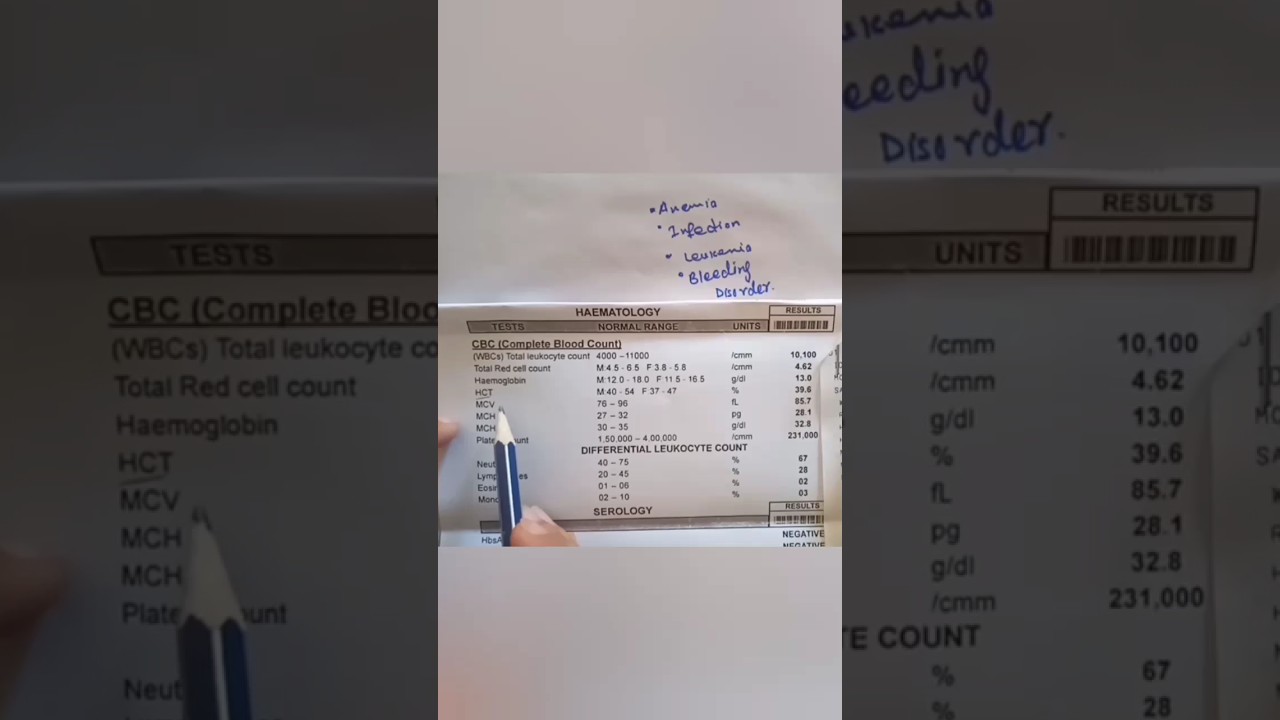 HCT ,CBC blood test|| Complete Blood Count|| #shorts #viralshorts