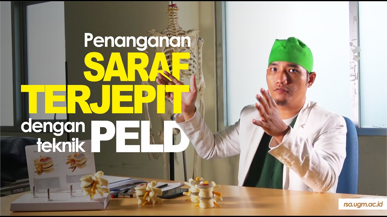 Anda mengalami saraf terjepit , bagaimana cara penanganannya ?