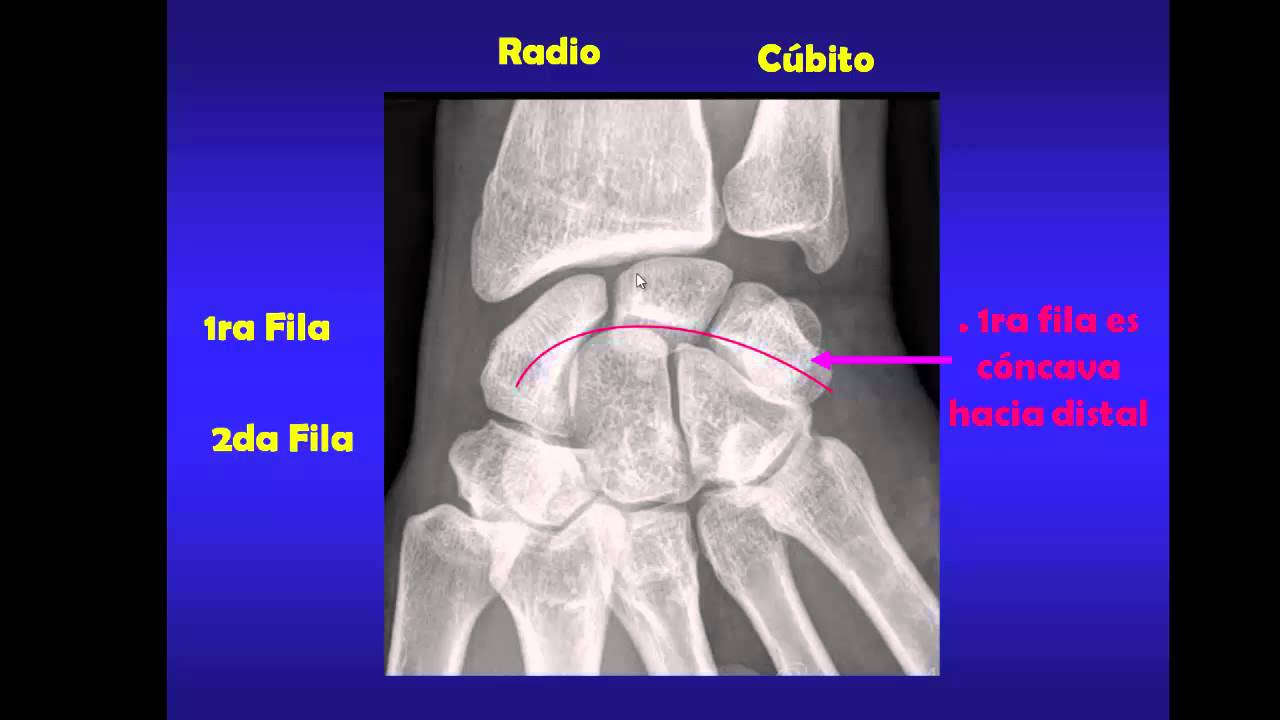 CODO, MUÑECA Y MANO