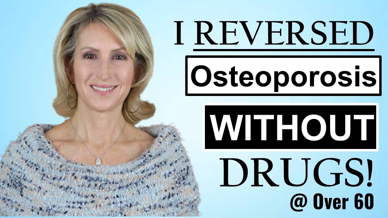 I Reversed Osteoporosis Naturally, Without Drugs!