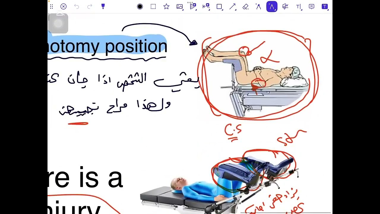 اسس التخدير / تخدير مرحلة ثالثة /المحاضرة الثانية /الجزء الثاني /منهج 2026 