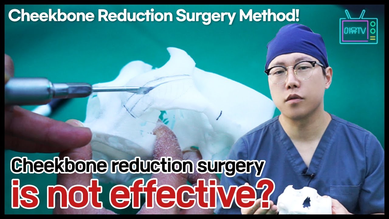 [EN/JP/TH/ SUB] Cheekbone Reduction Surgery Method! Cheekbone reduction surgery is not effective?
