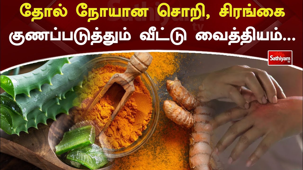 தோல் நோயான சொறி , சிரங்கை குணப்படுத்தும் வீட்டு வைத்தியம் | Web Special | Sathiyam Tv