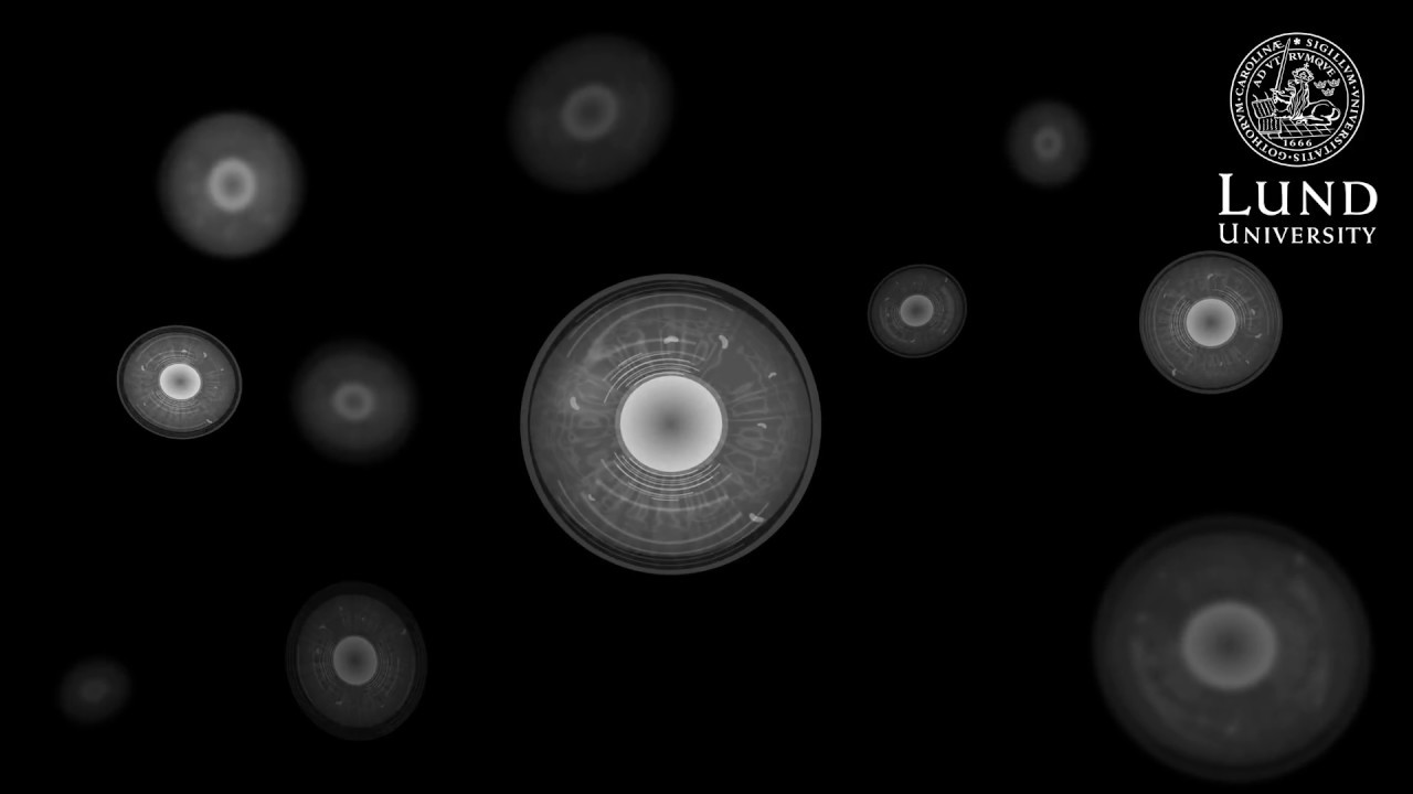 Amniotic fluid is a rich source of stem cells &ndash; that can now be harvested