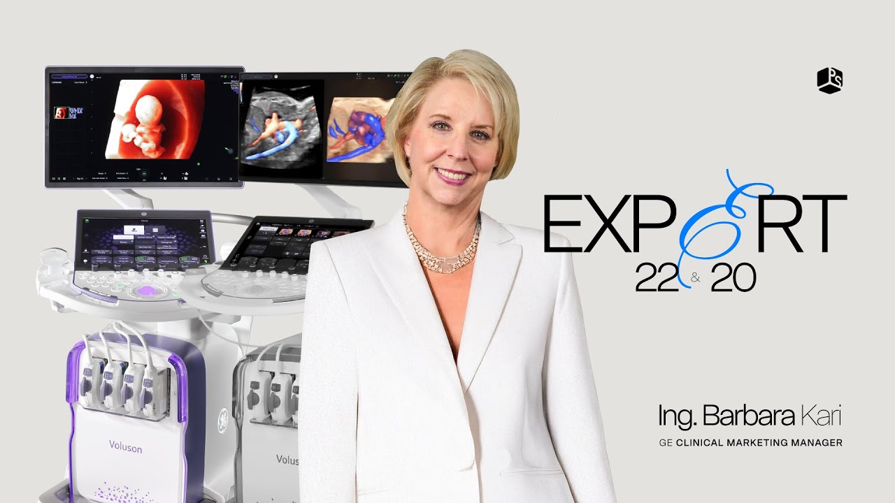 Diferencias entre Voluson Expert 20 y Voluson Expert 22