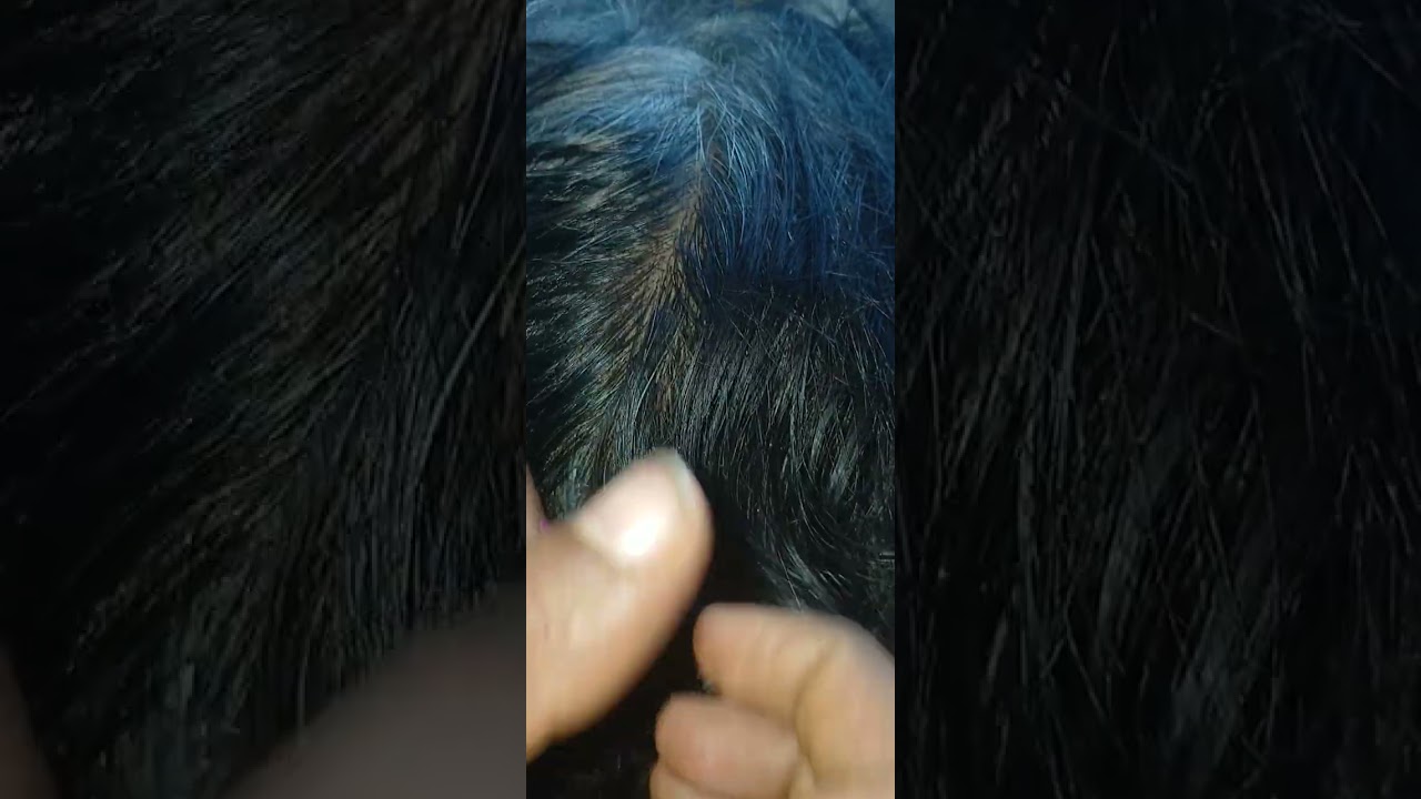 #asmr checking nits