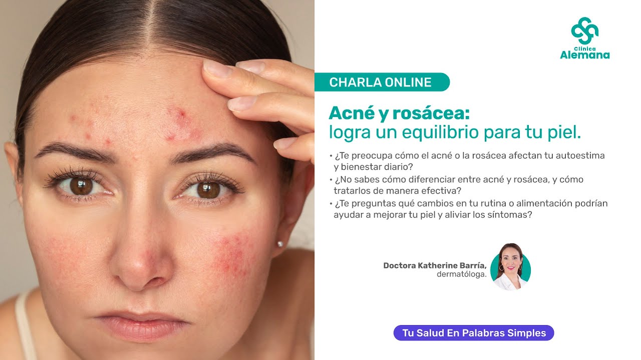 Acné y rosácea: logra un equilibrio para tu piel | Clínica Alemana