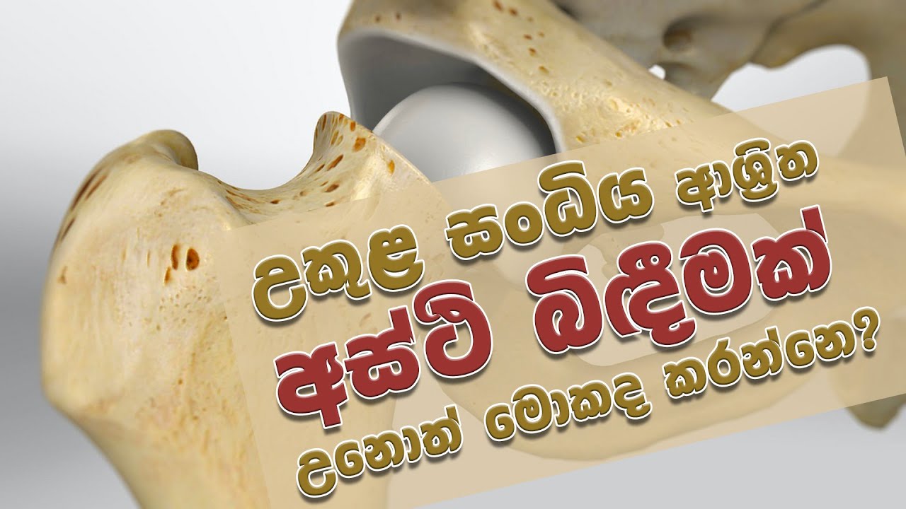 උකුළ සංධිය ආශ්‍රිත අස්ථි බිඳීම් | Life TV Sri Lanka | Life Today Sri Lanka