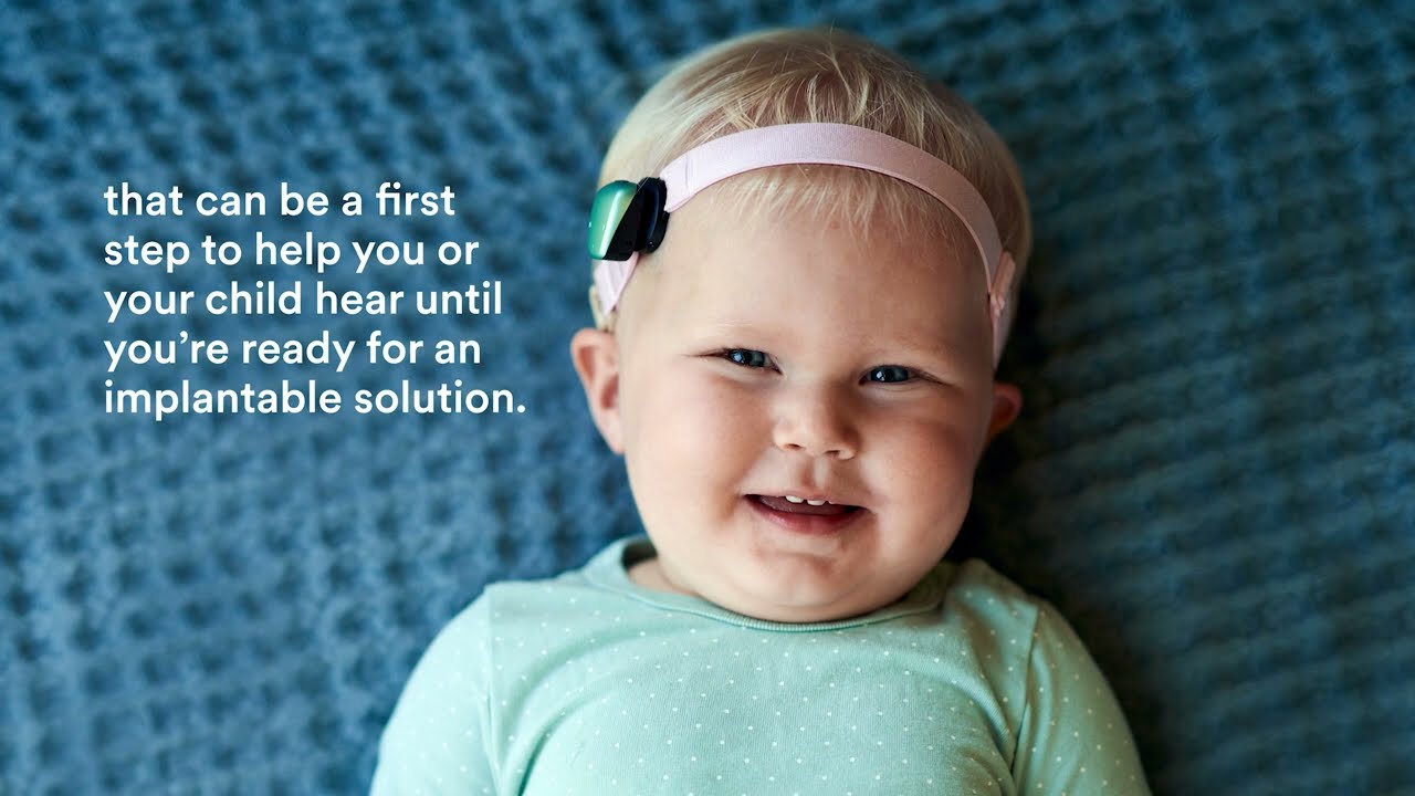 Cochlear&trade; Baha&reg; Start | Cochlear Americas