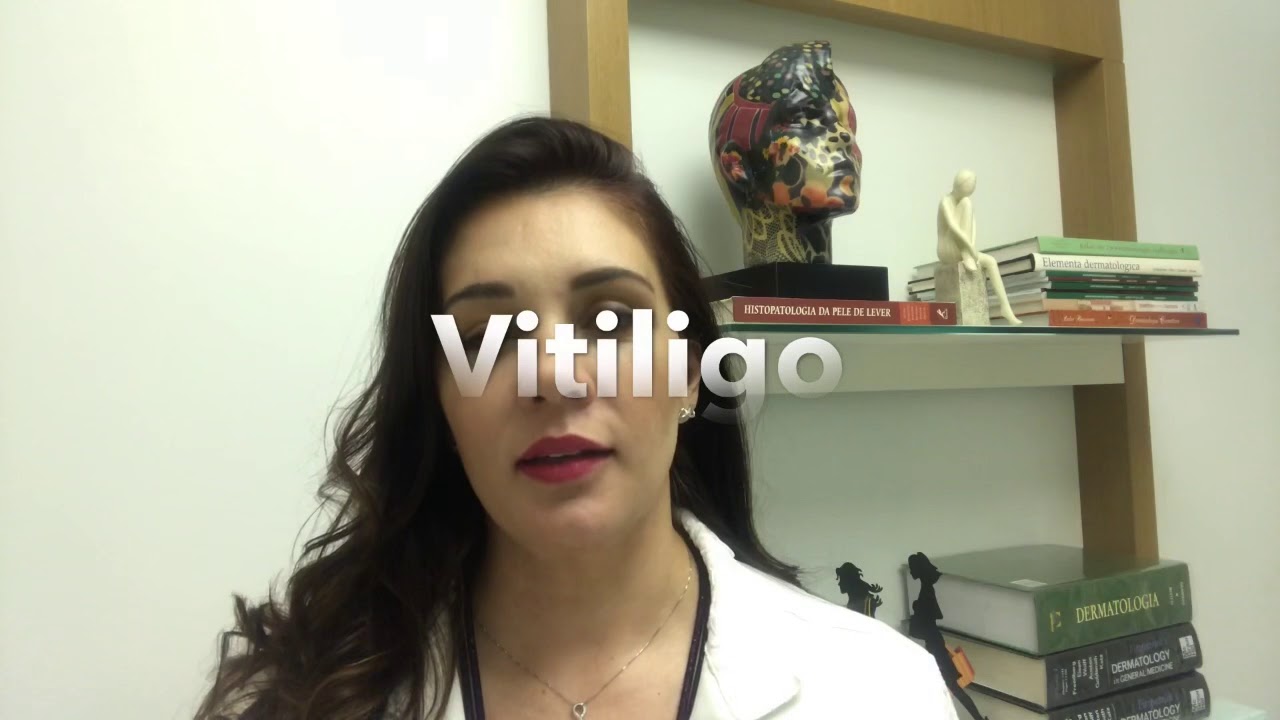 Mancha branca pode ser vitiligo?