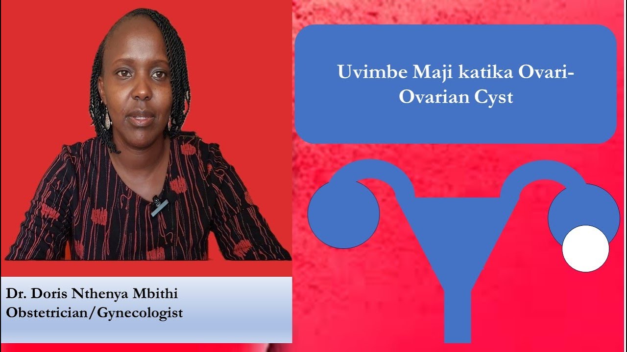 Uvimbe Maji Katika Ovari - Ovarian cyst
