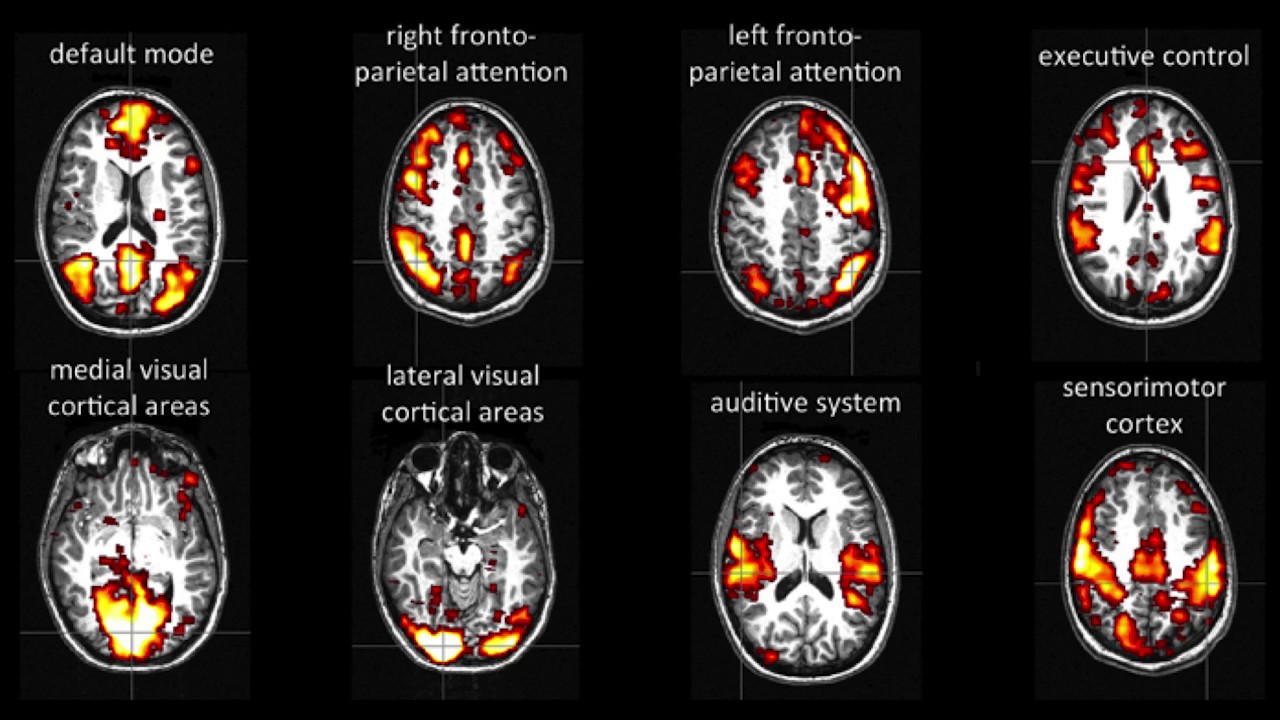 Resting-State Functional Connectivity in AFNI