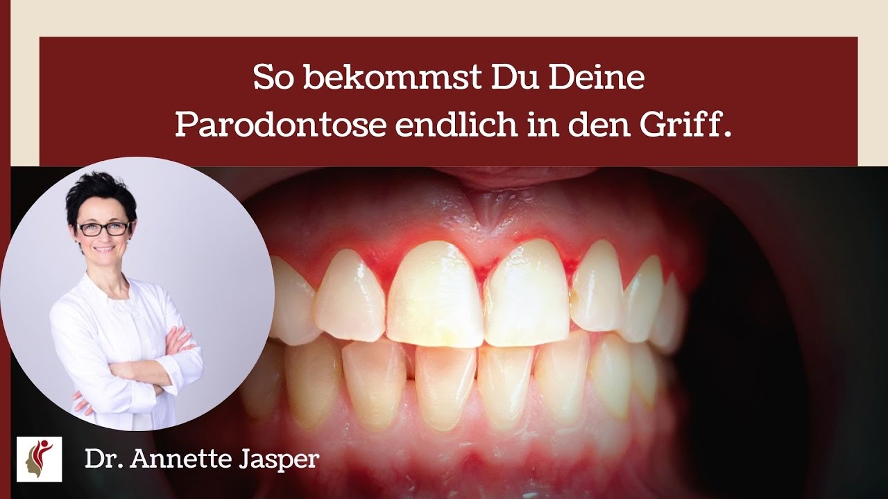 So bekommst Du Deine Parodontose endlich in den Griff.