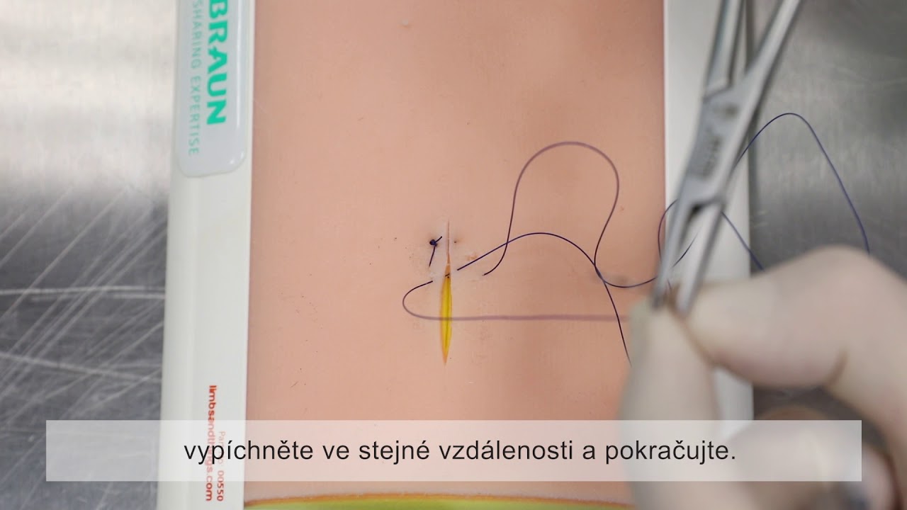 Chirurgické stehy: Pokračující steh (top view)