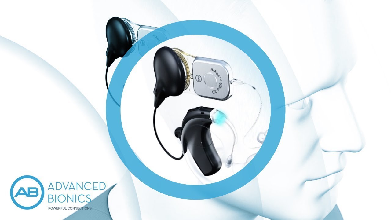 Hoe een cochleair implantaat werkt, door Advanced Bionics