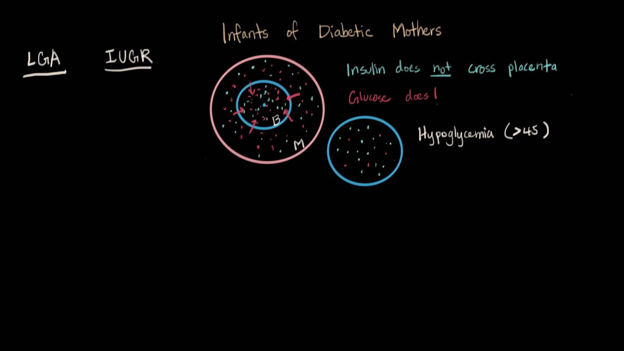 Infants of Diabetic Mothers