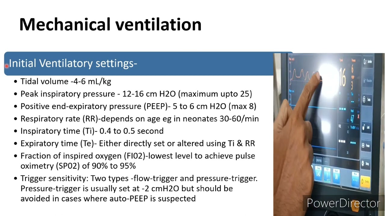 Mechanical Ventilation | Pediatrics
