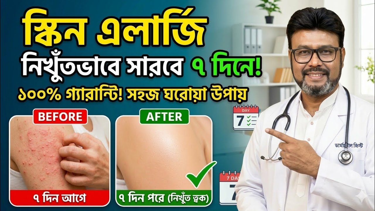 স্কিন এলার্জি থেকে মুক্তির উপায় ✅ Skin Allergy Treatment | অ্যালার্জি দূর করার উপায় | Dr. S.K. SEN