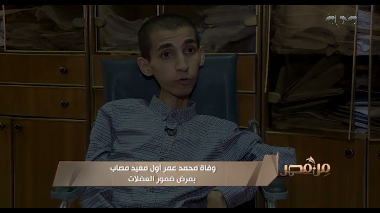 وفاة محمد عمر أول معيد مصاب بمرض ضمور العضلات