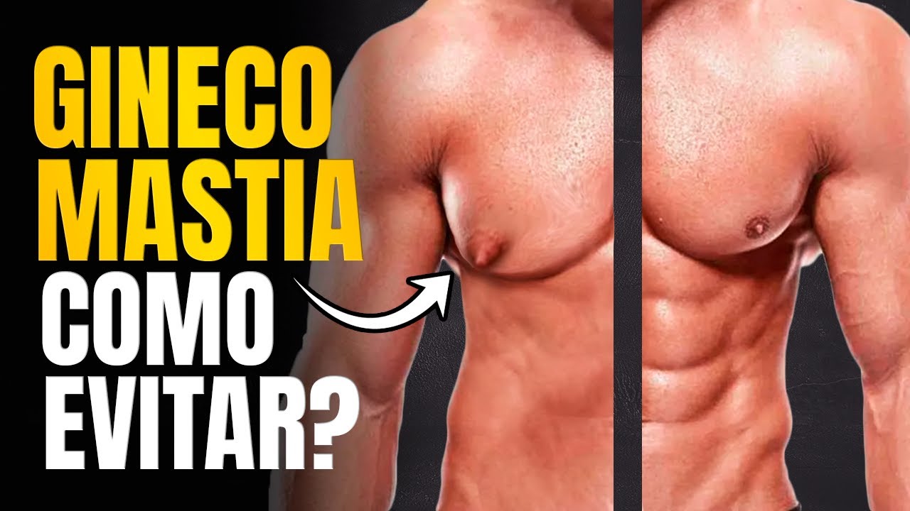 TUDO QUE VOCE PRECISA SABER PARA EVITAR GINECOMASTIA: 4 FORMAS NATURAIS