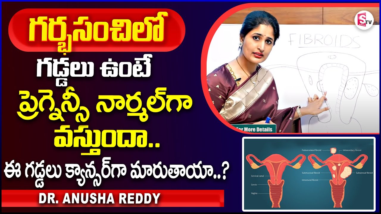 Dr. Anusha Reddy About  Pregnancy With Fibroids | Ferty 9 Fertility Centre | Suman TV