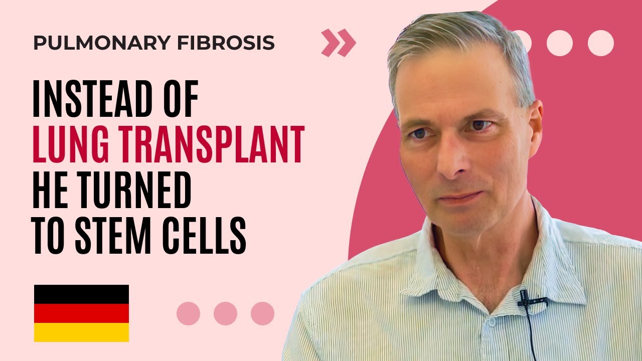 Stem Cells for Pulmonary Fibrosis: Story of 61-year-old Patient from Denmark