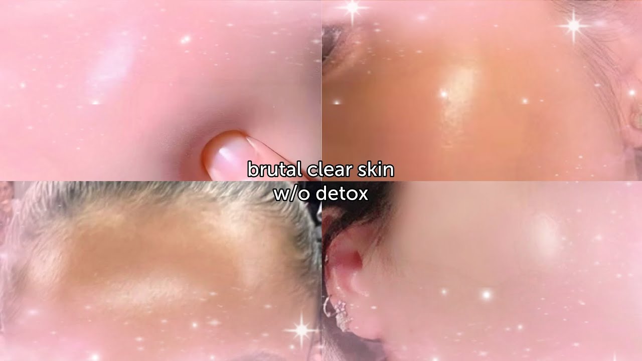 #BRUTAL Clear skin w/o detox 🍵ೀ