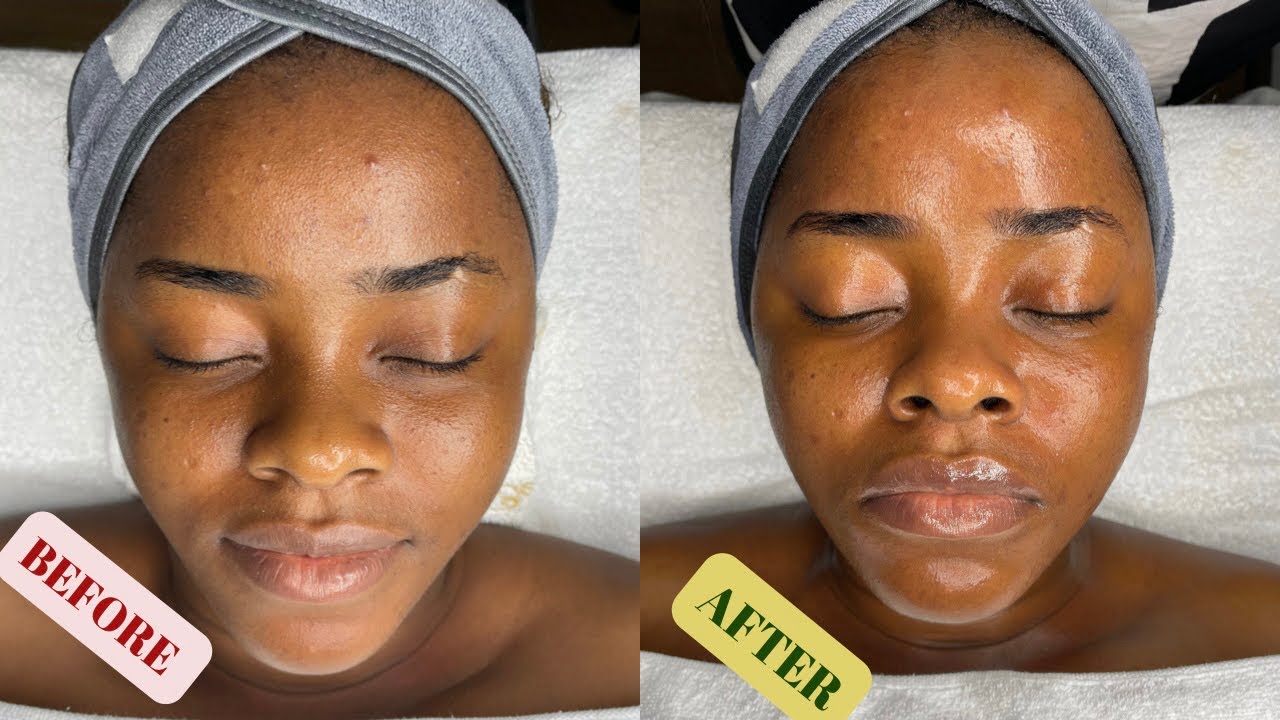 Classic facial Treatment for a first timer
