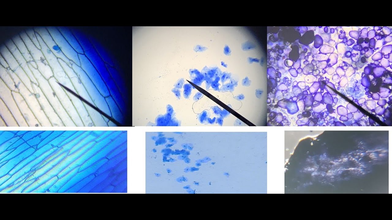 Tinción de células y visualización con microscopio óptico y microscopio casero