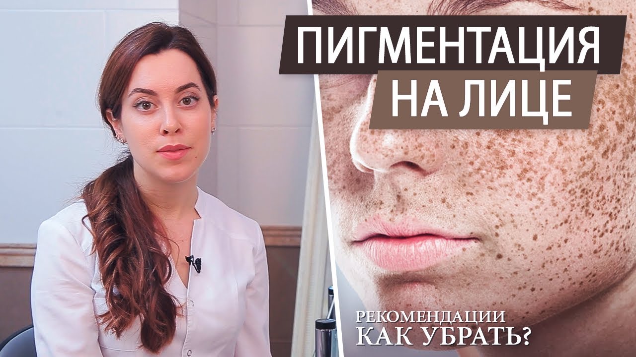 Рекомендации косметолога. Пигментные пятна на лице – причины и как избавиться