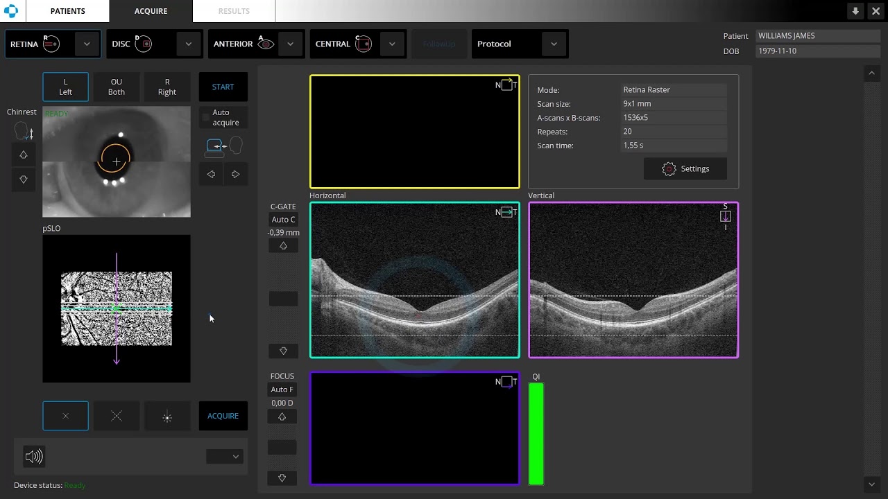 01 Retina Raster Manual Mode