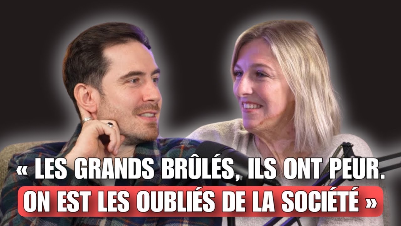 BRÛLÉE VIVE À 16 ANS, ELLE SURVIT AUX FLAMMES, TRANSFORME SON DESTIN ET INSPIRE 650 000 PERSONNES !