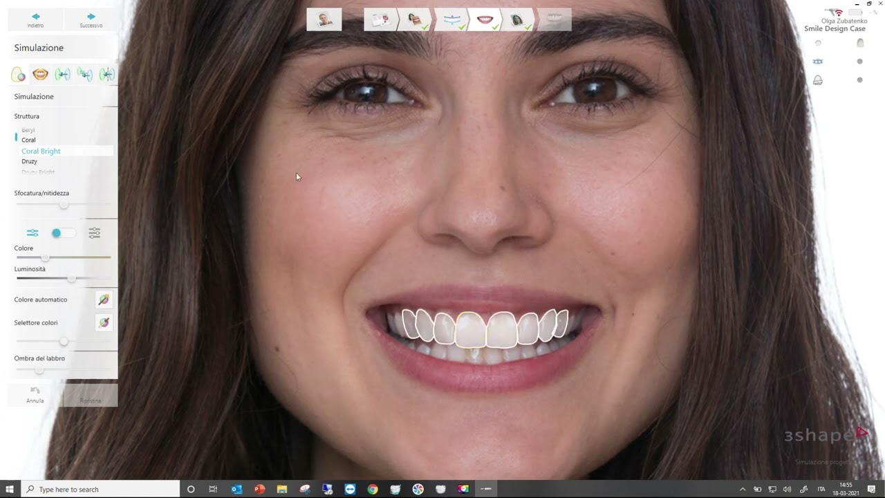 Smile design 3shape
