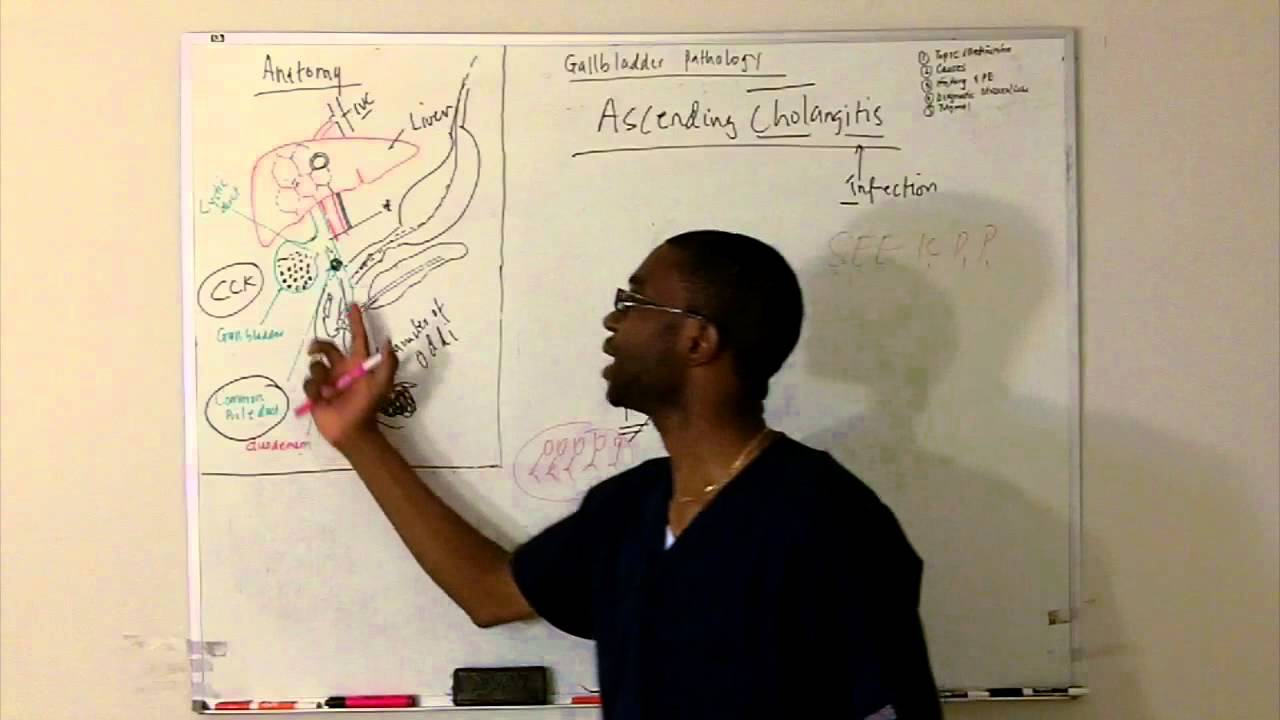 Choledocolithasis- lecture in HD!