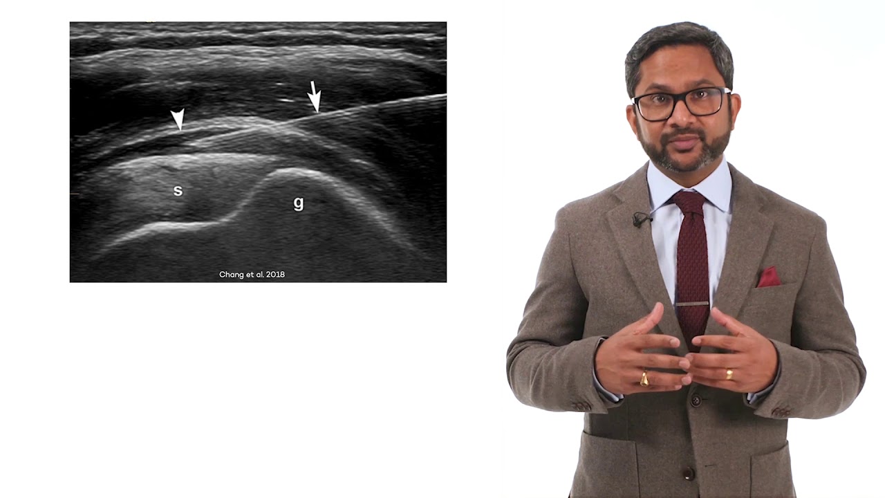 MSK Ultrasound guided injection course preview