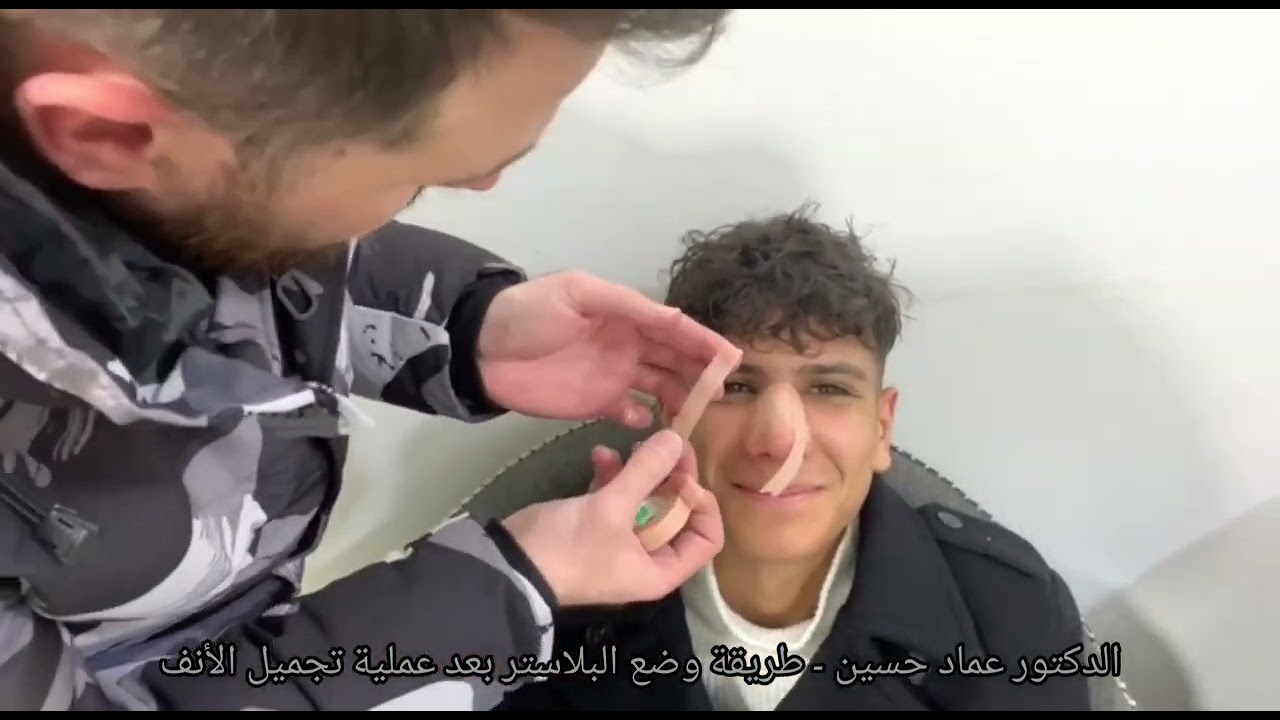طريقو وضع البلاستر الورقي (اللاصق) على الأنف بعد عملية تجميل الأنف بالمختصر المفيد