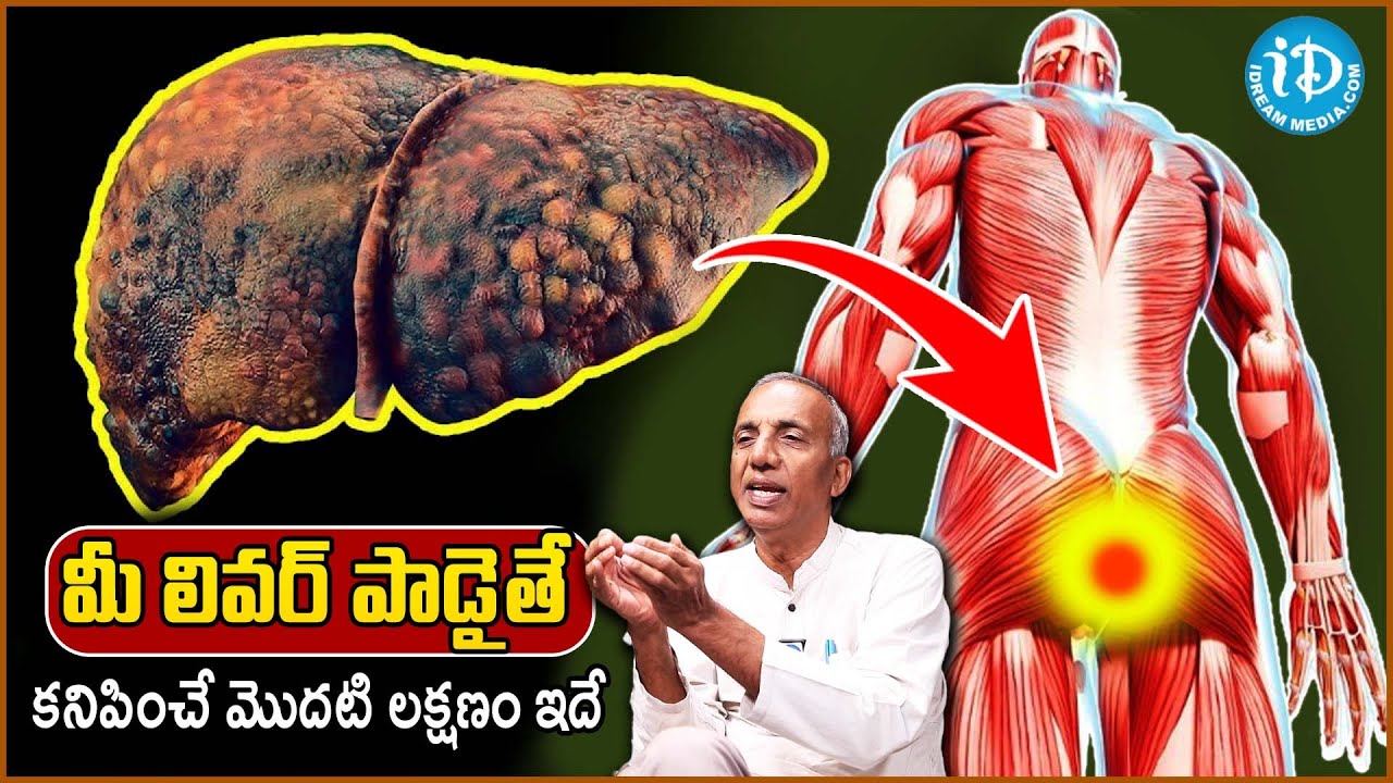 10 Symptoms of Liver Problem | Fatty Liver Symptoms | liver damage Sign | Prakruthi Vanam Prasad