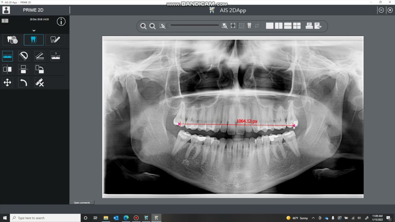 Acteon AIS and AIS 3D Training