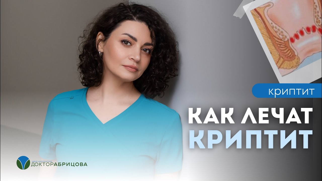 Что такое криптит и как его лечить? Проктолог Марьяна Абрицова