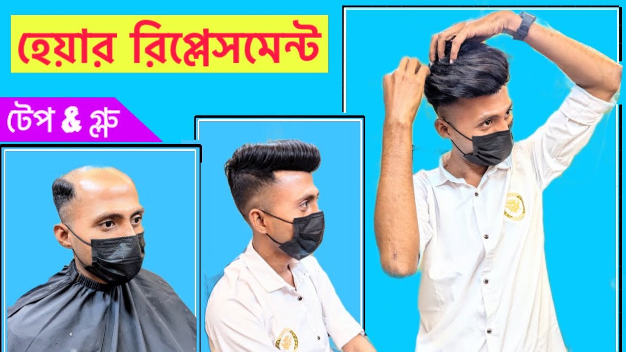 non surgical hair replacement system in dhaka Farmgate | fixed system hair patch | hair style int