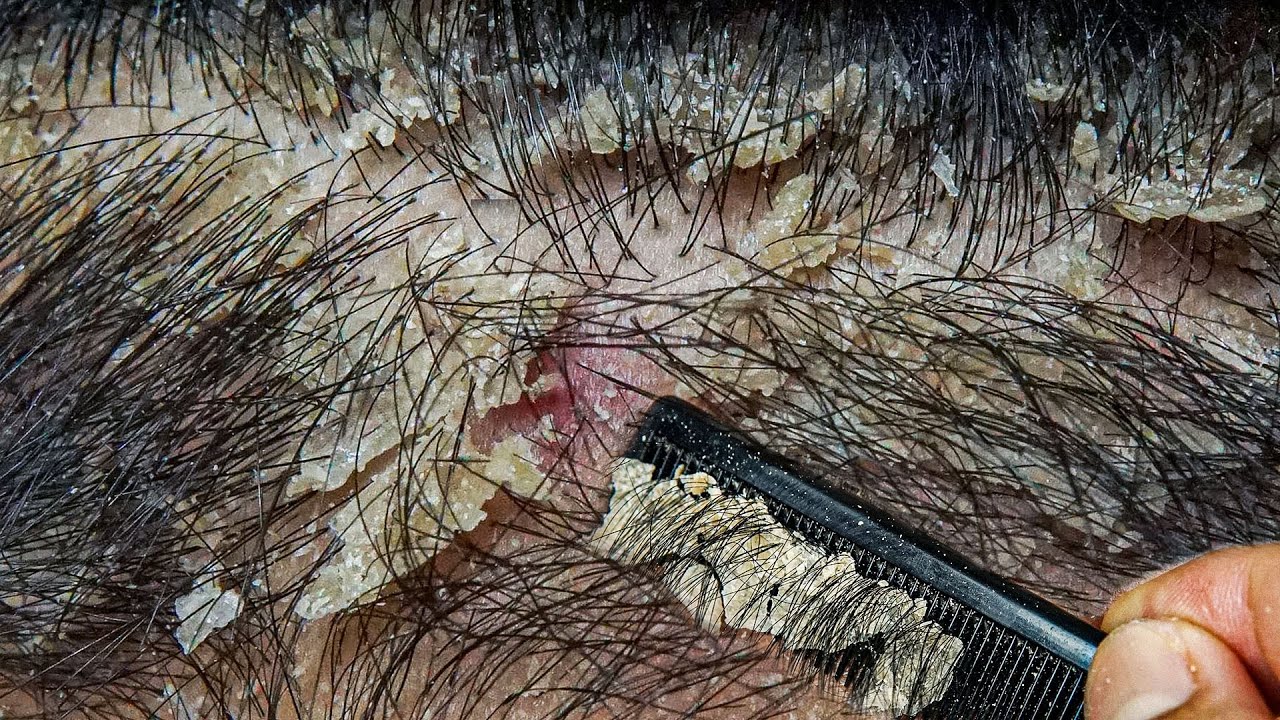 Ultimate Relaxation with Comb #DMO3759