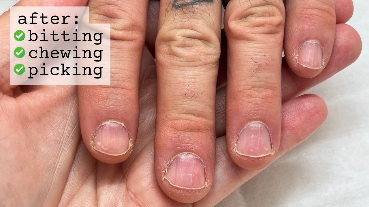 How to re-start your nails (after falling off the wagon) WEEK 0