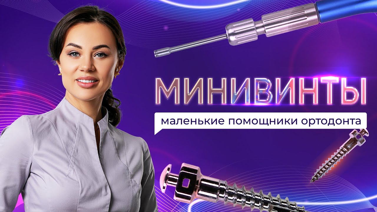 Минивинты - Зачем их устанавливают, плюсы и минусы. Кто решает устанавливать минивинты?