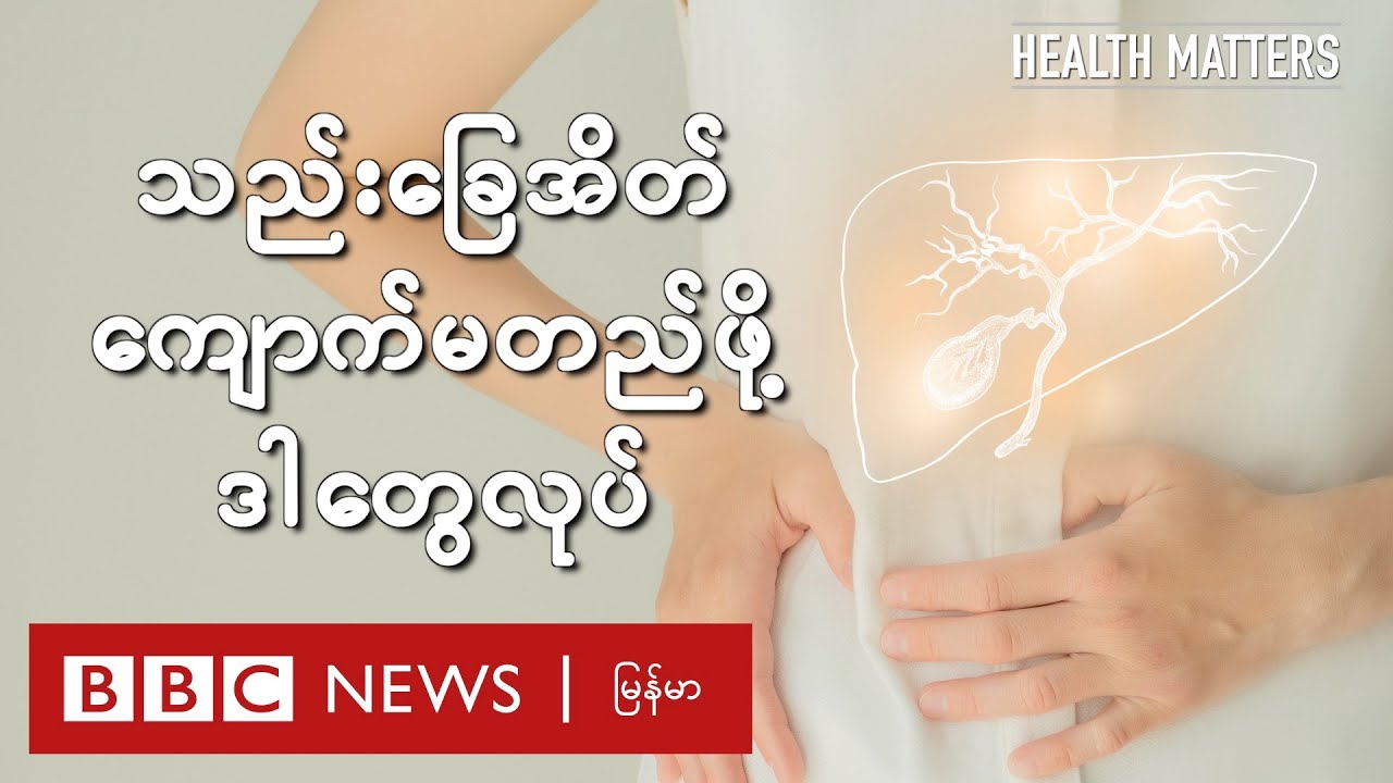 သည်းခြေအိတ် ကျောက်မတည်ဖို့ ဒါတွေလုပ်  - BBC News မြန်မာ