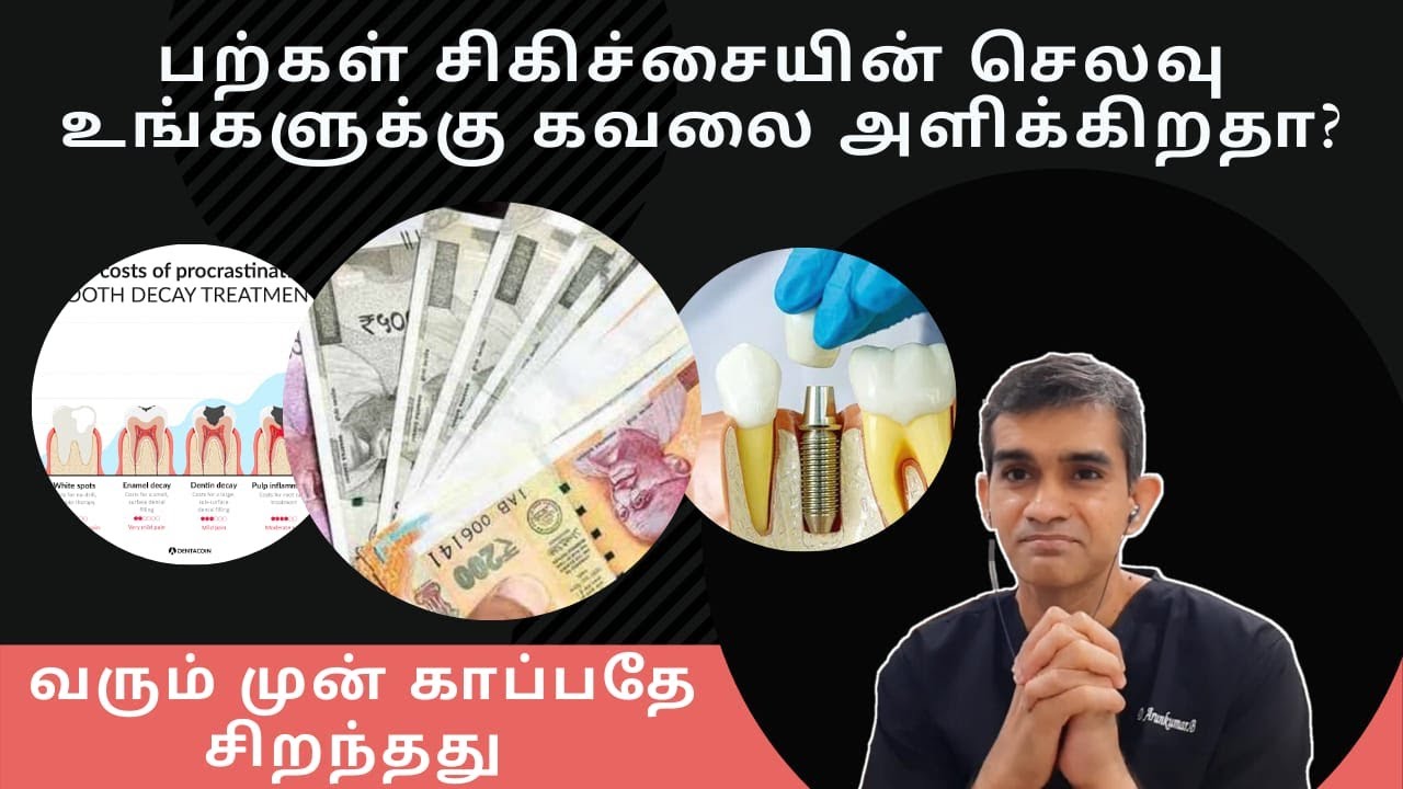 பல் சிகிச்சையின் செலவு உங்களுக்கு கவலை அளிக்கிறதா | Dr Arunkumar Chennai வரும் முன் காப்பதே சிறந்தது