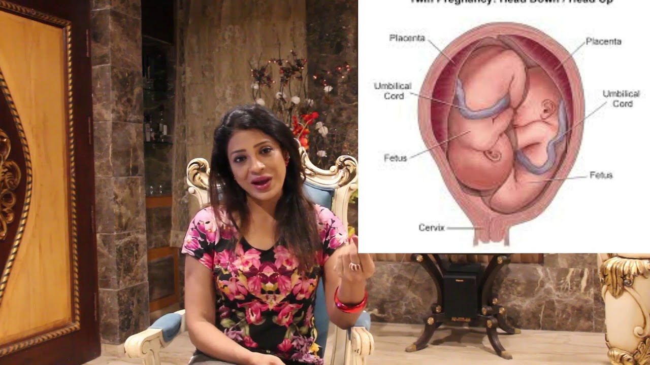 Twin Pregnancy English, Problems & complications in twin pregnancy