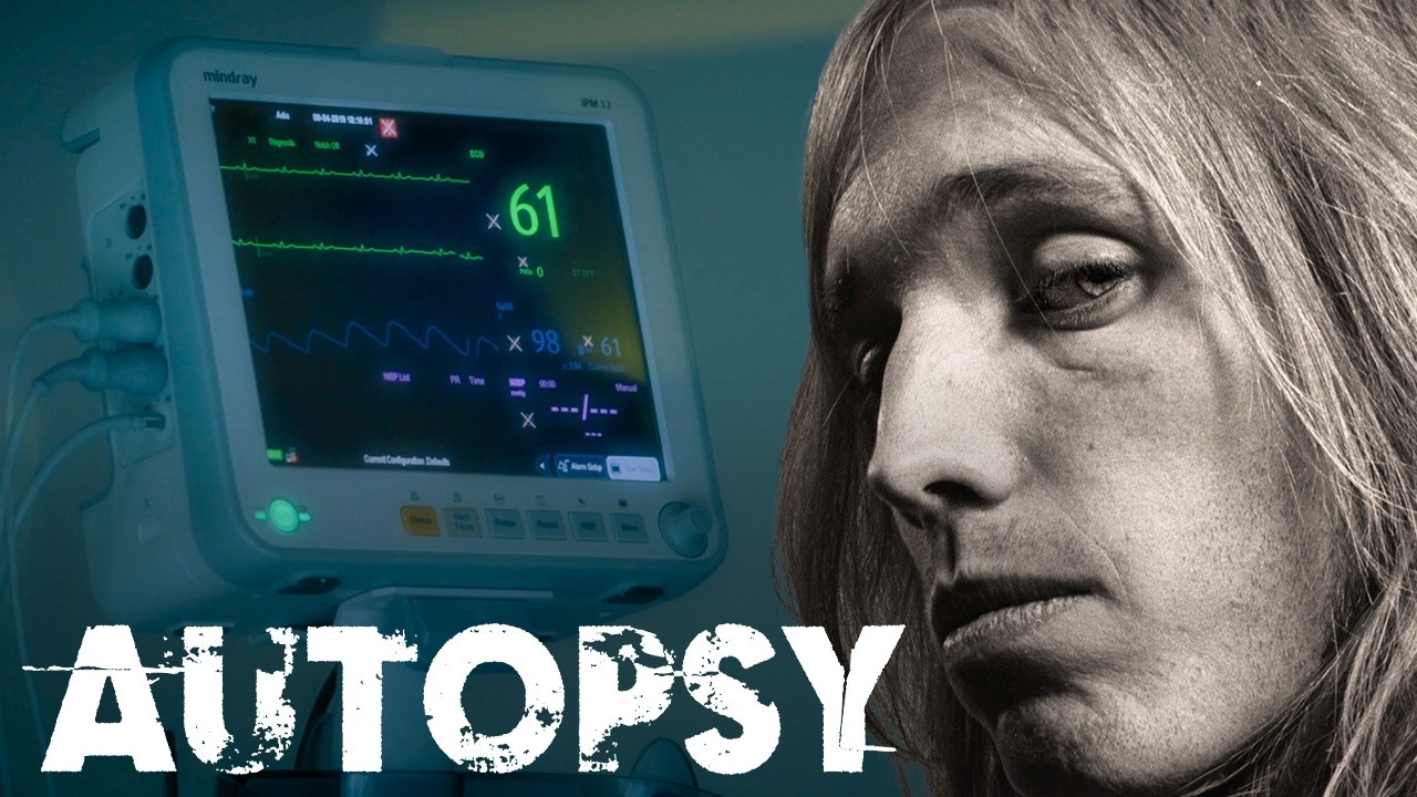 What Caused Tom Pettys Tragic Death Just One Week After His Sold Out Tour | Our History