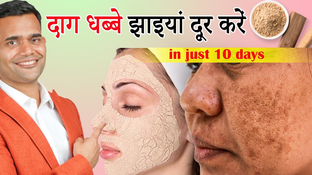 दाग धब्बे झाइयां दूर करें |Get Rid of Pigmentation melasma dark spots naturally