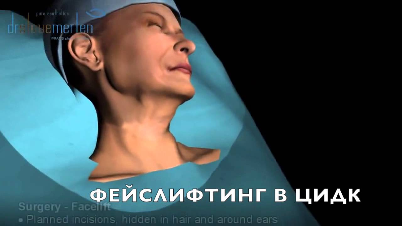 фейслифтинг в ЦИДК